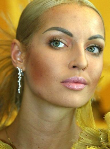 FOTO: Seksīgā balerīna Anastasija Voločkova cietusi autokatastrofā 