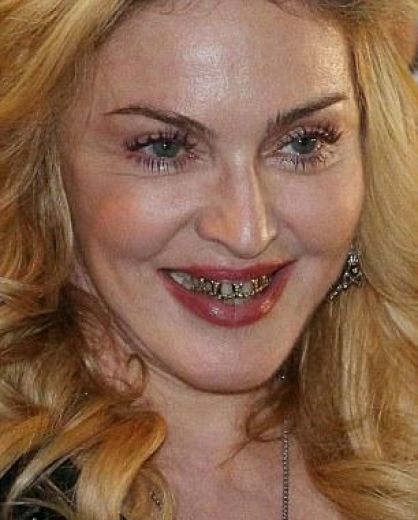 Kāpēc Madonnai mutē dzelzs gabali? Atbaidoša stila FOTO