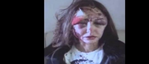 VIDEO: Krievu miljonārs bēguļo pēc savas draudzenes sejas sakropļošanas!