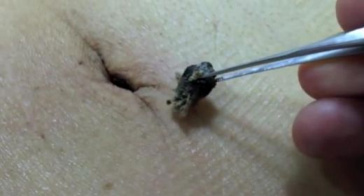 VIDEO: Diezgan pretīgi! Lūk, kā izskatās netīrākā naba pasaulē